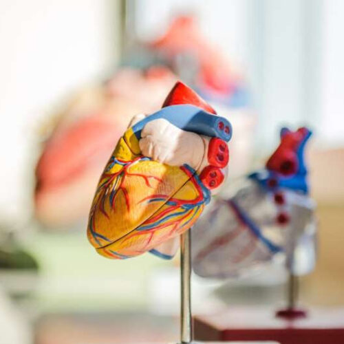 Modified pig-to-human heart transplant had unexpected changes in the heart’s conduction system
