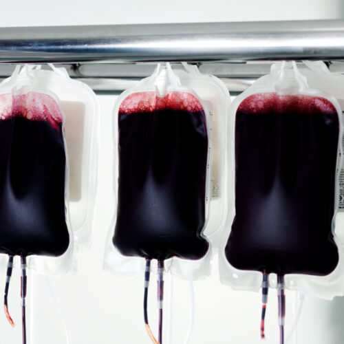 Scientists Have Discovered a New Set of Blood Groups