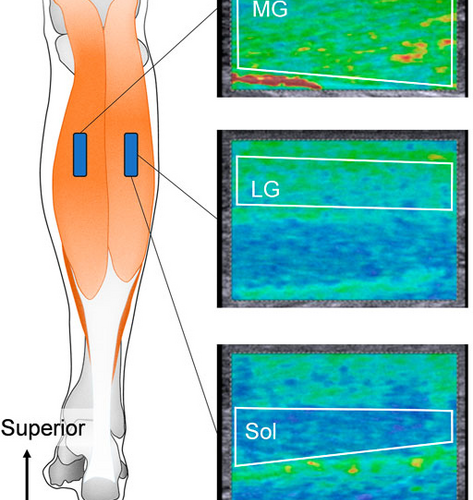 Muscling through: Linking muscle and joint stiffness of the lower human limbs