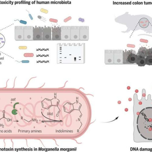 Family of DNA damage–inducing microbial metabolites found in guts of people with IBS