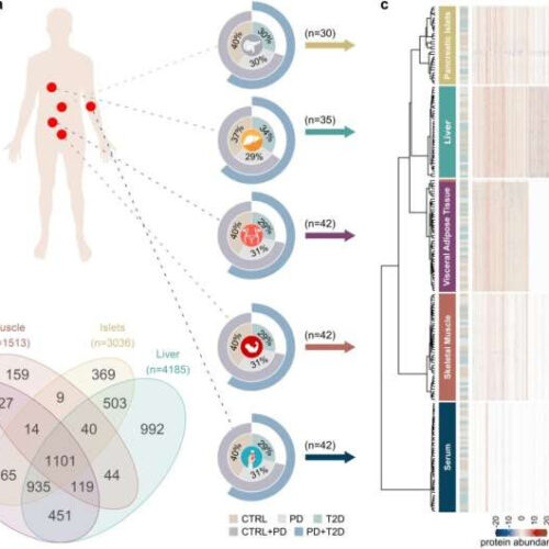 Widespread dysregulation of metabolism in type 2 diabetes