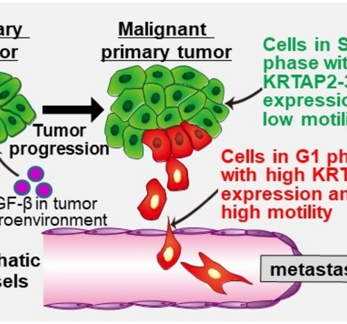 Stopping the spread: Targeting tumor metastasis