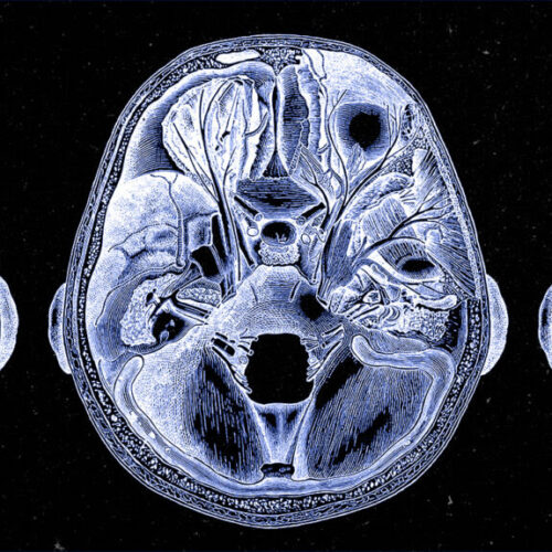 Scientists find the brain cells that drive us to eat fat, sugar