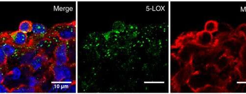 Identification of molecule capable of reducing neurodegenerative processes in the elderly