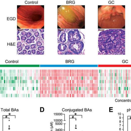 Salvia miltiorrhiza extract is a potential preventive agent for gastric cancer induced by bile reflux