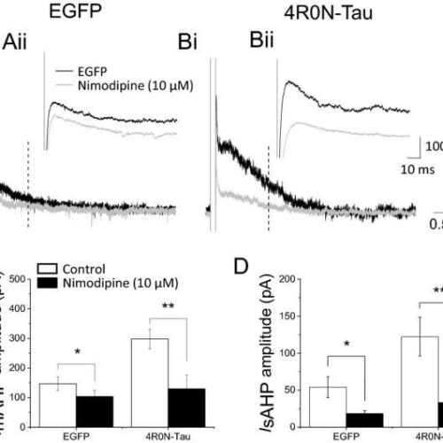 Ratio shift of protein in brain cells causes changes underlying early cognitive decline