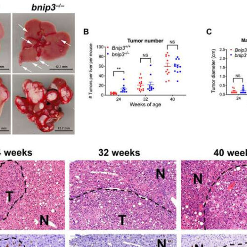 Increased mitochondria and lipid turnover reduces risk for liver cancer