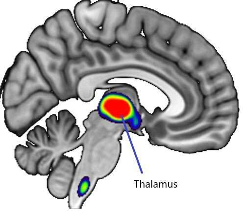 Nicotine dose in a single cigarette blocks estrogen production in women’s brains