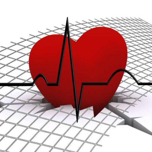 Using MRI to identify patients with sarcoidosis at risk for bad cardiac outcomes