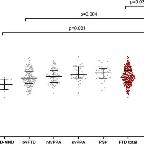 Serum TDP-43 levels may help identify neuropathological changes associated with frontotemporal dementia