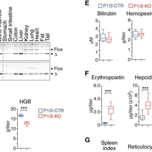 Iron deficiency suppresses important arm of the innate immune system