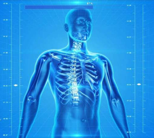 Dissemination of bone metastasis linked with bone remodeling