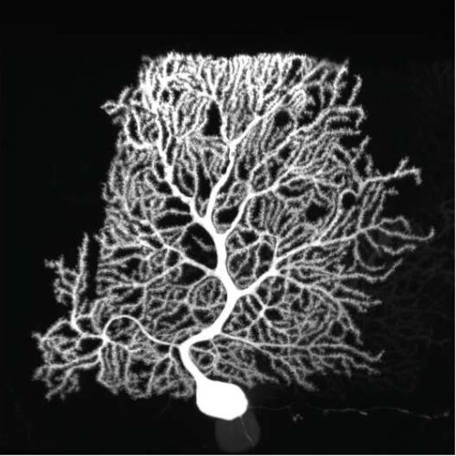 New proteomic technique reveals secrets of dendrite development