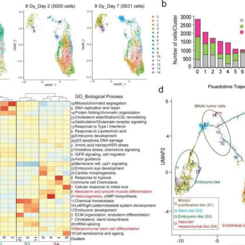 Researchers identify a gene as a potential target in treatment-resistant brain cancer glioblastoma multiforme