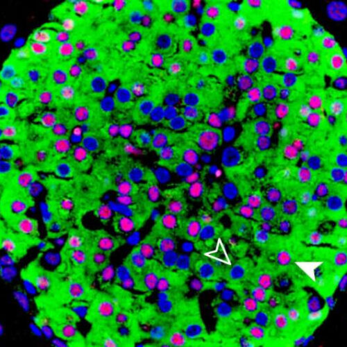 Diabetes-causing gene can be regulated like a rheostat