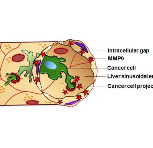 Study finds the mechanism used by metastatic cancer cells to infiltrate the liver