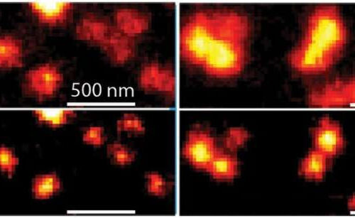 Identifying and attacking the HIV virus’s most dangerous parts may now be possible