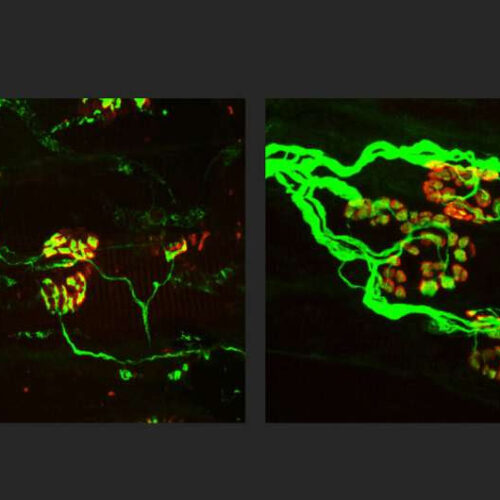 New strategy shows potential to block nerve loss in neurodegenerative diseases