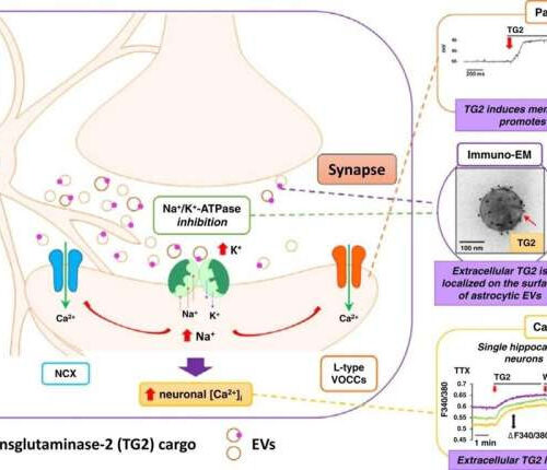 Microscopic ‘nano-shuttles’ may help drive degeneration of brain cells, research suggests