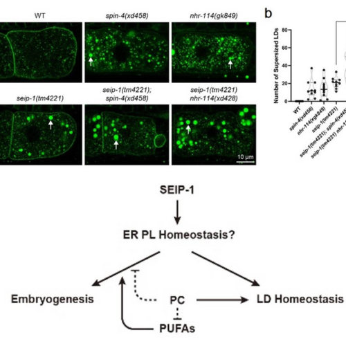 PC deficiency suppresses seipin: New insights into Berardinelli-Seip congenital lipodystrophy type 2