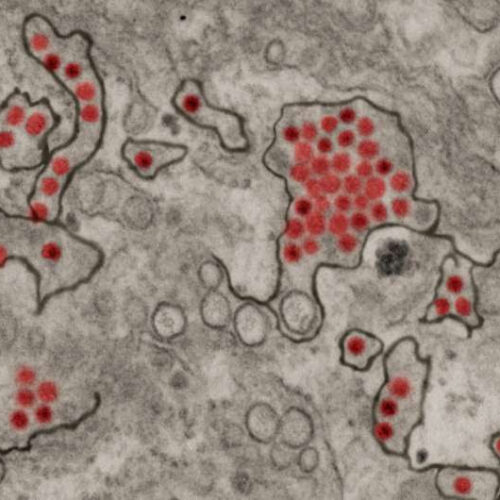 Unusual type of antibody shows ultrapotent activity against Zika