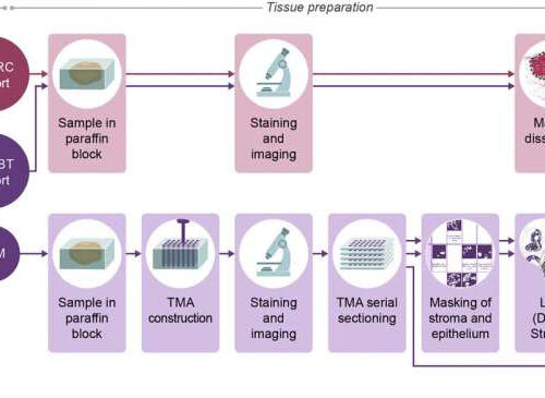 Newly developed gene classifier identifies risk of pre-breast cancer progression