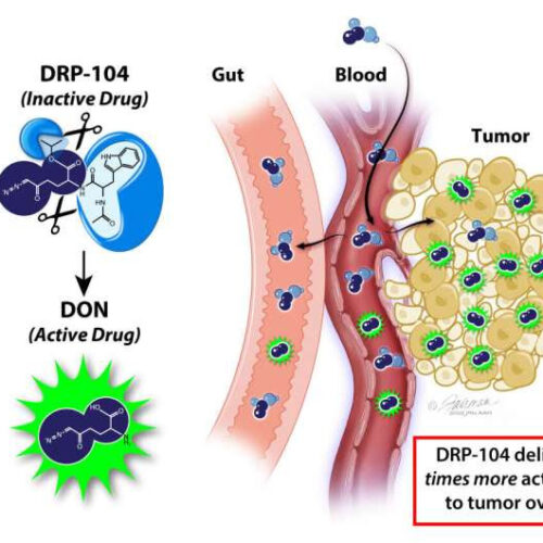 Researchers design ‘prodrug’ that targets cancer cells’ big appetite for glutamine, leaving healthy cells unharmed