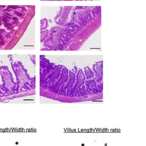 How repairing the gut saves brain function after stroke