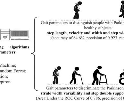 Artificial intelligence helps detect gait alterations and diagnose Parkinson’s disease