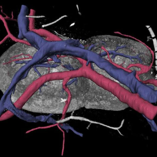 3D analyses of vascular network morphology reveal how lymph nodes are supplied with blood