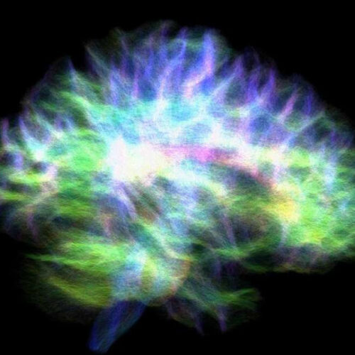 Most detailed map of brain’s memory hub finds connectivity puzzle