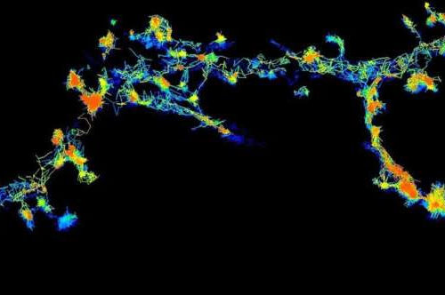 Cleaning up toxic ‘protein clumps’ could prevent dementia