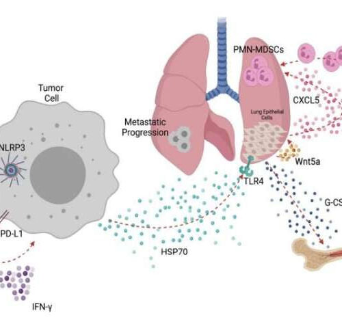 Biomarker predicts resistance to immunotherapies in melanoma