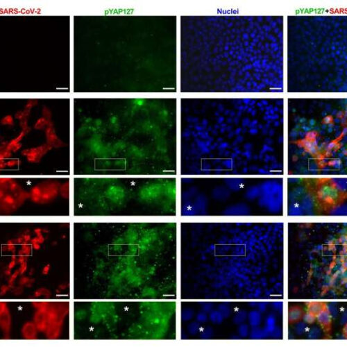 Scientists say eye-disease drug may also help fight COVID