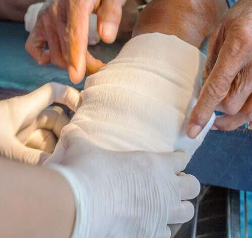 New material helps diabetic wounds heal quickly