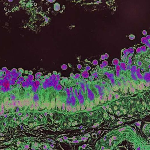 A common dietary fiber promotes allergy-like immune responses in preclinical studies