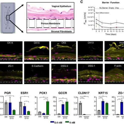 A breakthrough in bacterial vaginosis treatment for women’s health