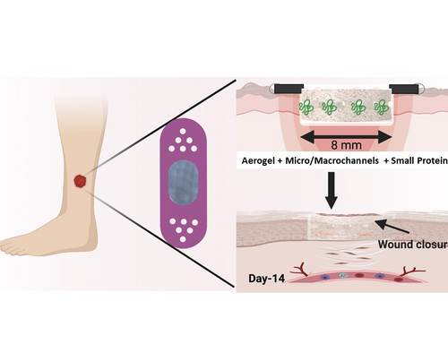 Microchannel-containing nanofiber aerogels with small protein molecule enable accelerated diabetic wound healing