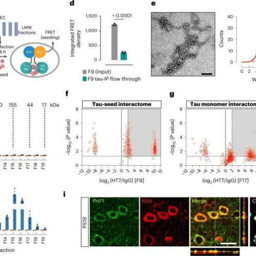 Researchers identify protein that contributes to tau neurotoxicity in Alzheimer’s disease