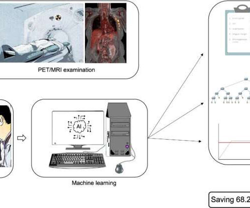 PET/MRI machine learning model can eliminate sentinel lymph node biopsy in majority of breast cancer patients