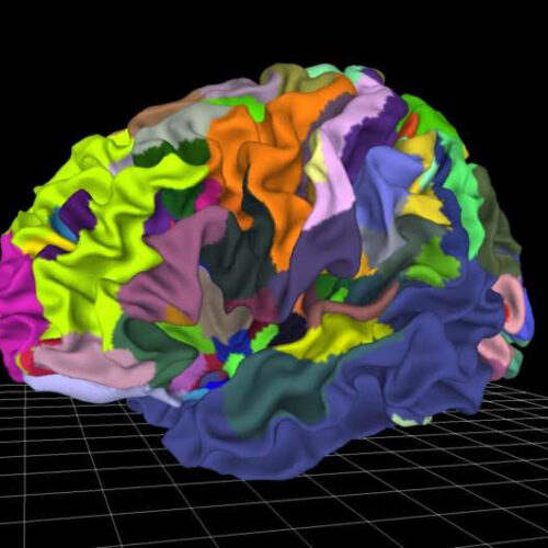 Multilevel brain atlases provide tools for better diagnosis of psychiatric and aging disorders