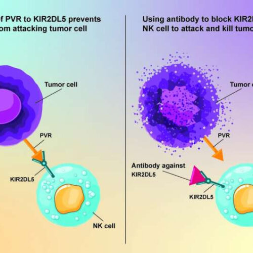 Developing a promising new cancer therapy based on natural killer cells