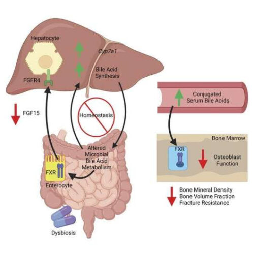 Treating acne with systemic antibiotics can have unintended consequences on maturing adolescent skeleton