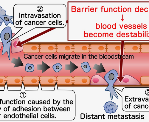 Promotion of cancer progression via extracellular vesicles