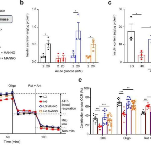 Study uncovers key cause of type 2 diabetes