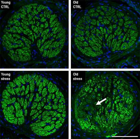 New study shows repeated stress accelerates aging of the eye