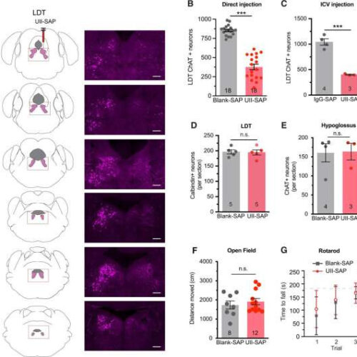 Link between sleep apnea and dementia, according to a study in mice