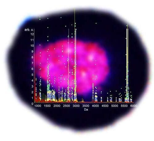 Understanding the differences between healthy and type 2 diabetes-affected pancreatic islets