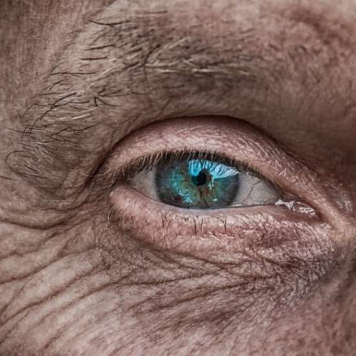 Aging eyesight issues and treatment