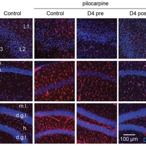 Neuroscientists discover a new drug candidate for treating epilepsy